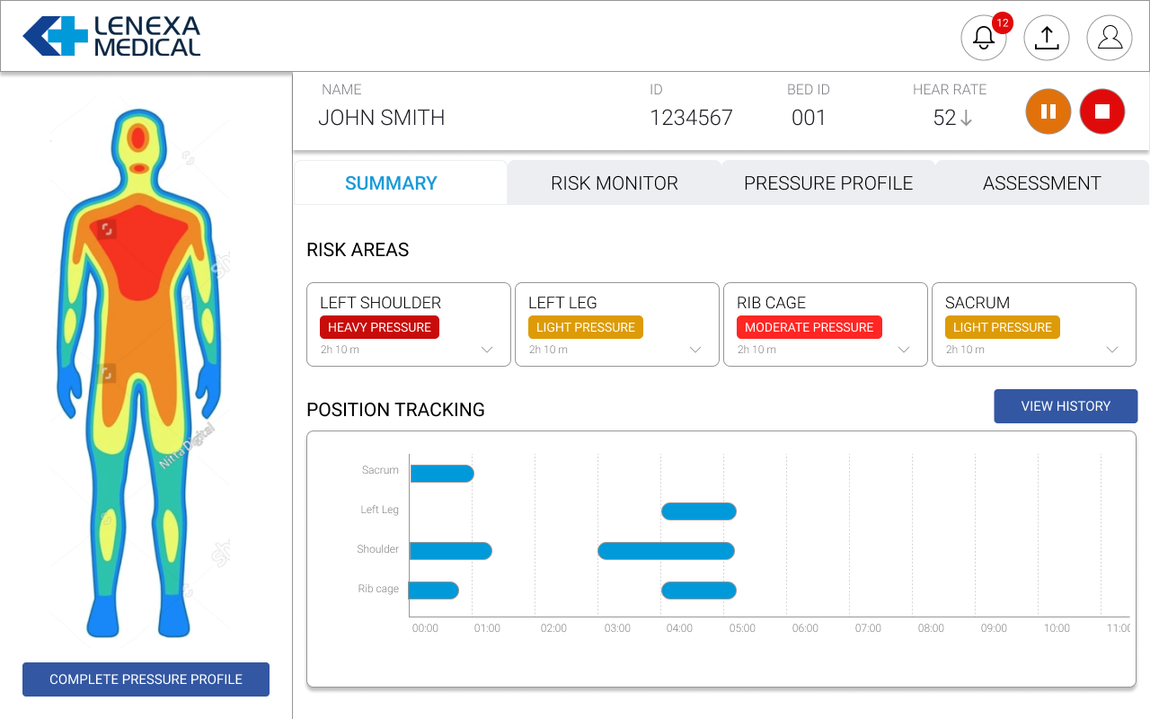 Clinical monitoring dashboard — persistent body map left panel, risk cards, 4-tab navigation, and 12-hour position tracking timeline